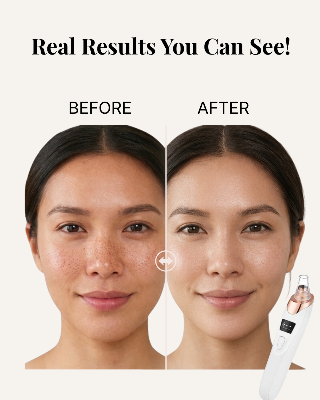 Clear What Your Cleanser Can’t Reach.